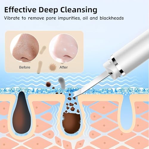 Skin Scrubber Exfoliating Device: Face Cleanser & Blackhead Remover - Pores Cleaning & Wrinkle Remover - 4 Modes - USB Rechargeable
