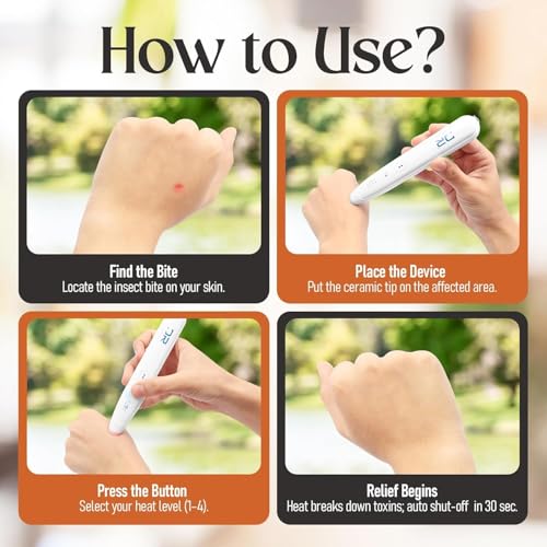 Dynamic Revive Itch Healer - Electronic Bite Relief Device - For Mosquito, Bee, Spider - Rechargeable, 4 Temp Modes - Kid & Adult