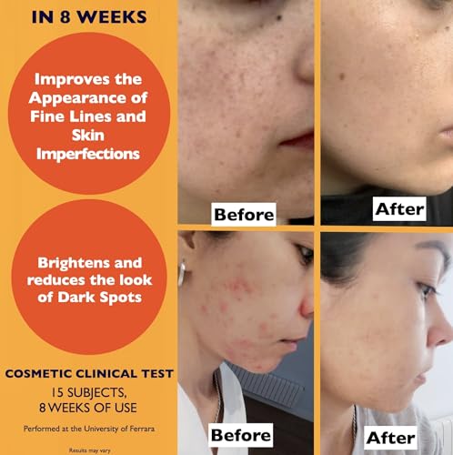 Organic Vitamin C Serum for Face: Anti-Dark Spots, Wrinkles & Hydration. Brightening & Repair.