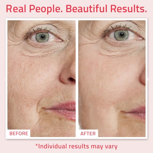 YEOUTH Retinol Serum: Hydrating Face Serum with Hyaluronic Acid & Vitamin E