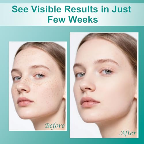 Skin Repair Cream for Dark Spots on Face & Body - Age, Sun, Freckles - All Skin Types - 1.7oz